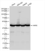 HARS Antibody in Western Blot (WB)