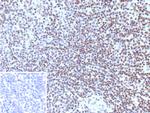Phospho-Histone H3 (Ser10) Antibody in Immunohistochemistry (Paraffin) (IHC (P))