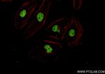 HEY2 Antibody in Immunocytochemistry (ICC/IF)
