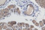 SLC17A9 Antibody in Immunohistochemistry (Paraffin) (IHC (P))
