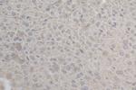 SLC17A9 Antibody in Immunohistochemistry (Paraffin) (IHC (P))