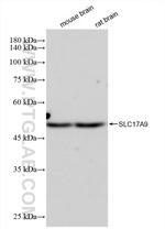 SLC17A9 Antibody in Western Blot (WB)