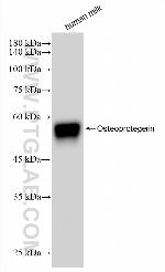 Osteoprotegerin/TNFRSF11B Antibody in Western Blot (WB)