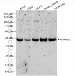 GPR105 Antibody in Western Blot (WB)