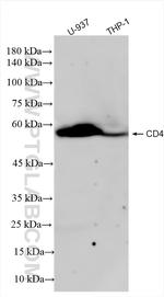 CD4 Antibody in Western Blot (WB)