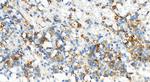 Integrin beta-5 Antibody in Immunohistochemistry (Paraffin) (IHC (P))