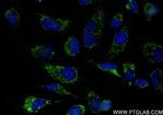MRPL40 Antibody in Immunocytochemistry (ICC/IF)