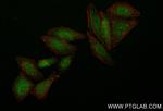 RPS11 Antibody in Immunocytochemistry (ICC/IF)