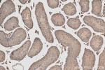 RPS11 Antibody in Immunohistochemistry (Paraffin) (IHC (P))