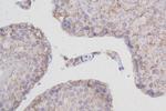 RPS11 Antibody in Immunohistochemistry (Paraffin) (IHC (P))