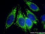 SOD2 Antibody in Immunocytochemistry (ICC/IF)