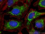 SOD2 Antibody in Immunocytochemistry (ICC/IF)