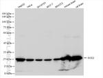 SOD2 Antibody in Western Blot (WB)