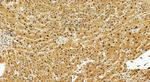 PSMD1 Antibody in Immunohistochemistry (Paraffin) (IHC (P))