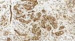 PSMD1 Antibody in Immunohistochemistry (Paraffin) (IHC (P))