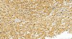 PSMD1 Antibody in Immunohistochemistry (Paraffin) (IHC (P))