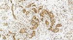 PSMD1 Antibody in Immunohistochemistry (Paraffin) (IHC (P))