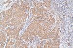ERK1/2 Antibody in Immunohistochemistry (Paraffin) (IHC (P))