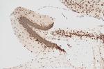 MED12L Antibody in Immunohistochemistry (Paraffin) (IHC (P))