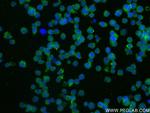 TIGIT Antibody in Immunocytochemistry (ICC/IF)
