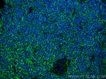 TIGIT Antibody in Immunohistochemistry (PFA fixed) (IHC (PFA))