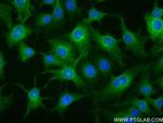 MBOAT7 Antibody in Immunocytochemistry (ICC/IF)