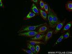 LONP1 Antibody in Immunocytochemistry (ICC/IF)