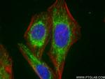 LONP1 Antibody in Immunocytochemistry (ICC/IF)