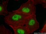 TMEM53 Antibody in Immunocytochemistry (ICC/IF)