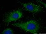 NLRP6 Antibody in Immunocytochemistry (ICC/IF)