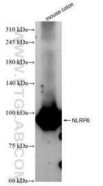NLRP6 Antibody in Western Blot (WB)
