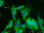 Gsdmd Antibody in Immunocytochemistry (ICC/IF)