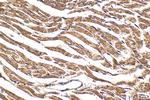 CORIN Antibody in Immunohistochemistry (Paraffin) (IHC (P))
