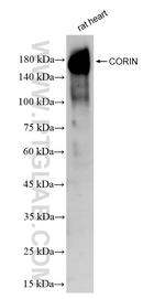 CORIN Antibody in Western Blot (WB)