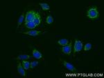 HIBCH Antibody in Immunocytochemistry (ICC/IF)