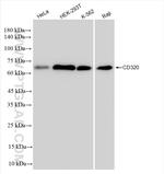 CD320 Antibody in Western Blot (WB)