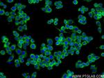 S100A9 Antibody in Immunocytochemistry (ICC/IF)