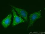 DHRS3 Antibody in Immunocytochemistry (ICC/IF)