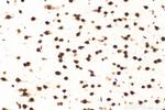 LUC7L Antibody in Immunohistochemistry (Paraffin) (IHC (P))