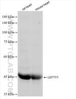 LEFTY1 Antibody in Western Blot (WB)