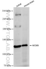 MCM9 Antibody in Western Blot (WB)