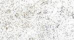 INTS4 Antibody in Immunohistochemistry (Paraffin) (IHC (P))