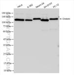 Drebrin Antibody in Western Blot (WB)
