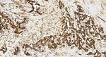 SENP1 Antibody in Immunohistochemistry (Paraffin) (IHC (P))