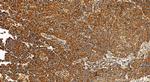 SENP1 Antibody in Immunohistochemistry (Paraffin) (IHC (P))