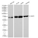 SENP1 Antibody in Western Blot (WB)