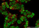 KMT2C Antibody in Immunocytochemistry (ICC/IF)