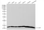 C11orf67 Antibody in Western Blot (WB)