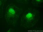 PIK3R2 Antibody in Immunocytochemistry (ICC/IF)