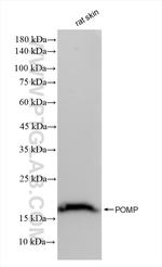 POMP Antibody in Western Blot (WB)